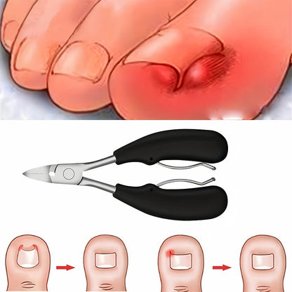 Angled-Jaw Nail Clipper Set, Five-Piece Black-Handle Kit with 25-Degree Tool, Lifter and File