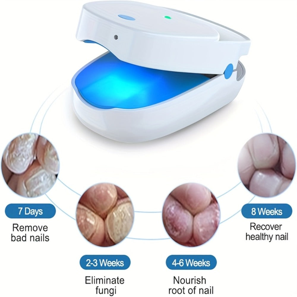 KTS Nail Fungus Laser Device FDA Cleared – Extra Strength 407nm Blue Light & 905nm Dual-Light Treatment for Toenail & Fingernail Fungus, Onychomycosis Home Removal Device