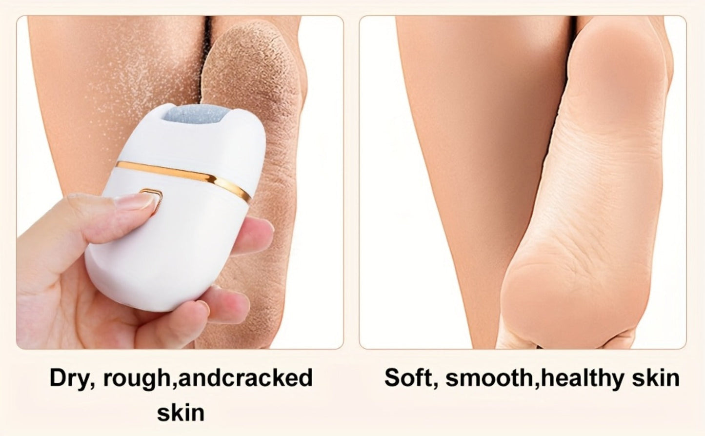 Rechargeable Electric Callus Remover with Three Replacement Heads, Two Speeds and USB Charging