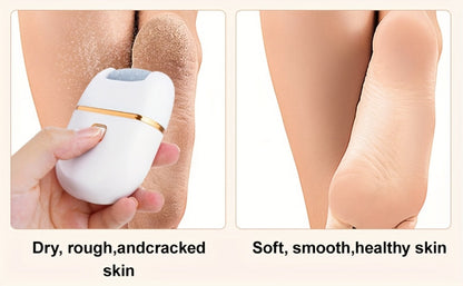 Rechargeable Electric Callus Remover with Three Replacement Heads, Two Speeds and USB Charging