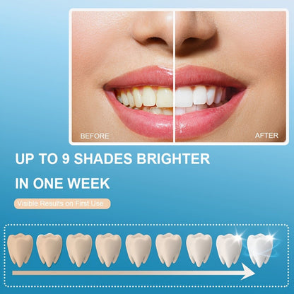White or Blue Five-LED Teeth Whitening Kit with Five Gel Syringes and 10.8 cm Mouthpiece Device