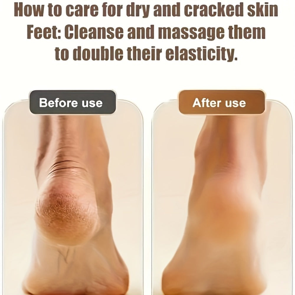 Rechargeable Electric Callus Remover with Three Replacement Heads, Two Speeds and USB Charging