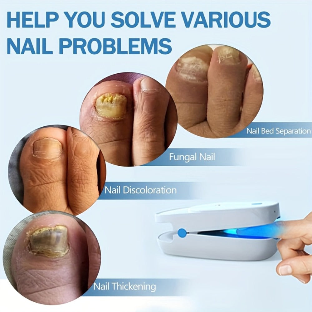 KTS Nail Fungus Laser Device FDA Cleared – Extra Strength 407nm Blue Light & 905nm Dual-Light Treatment for Toenail & Fingernail Fungus, Onychomycosis Home Removal Device