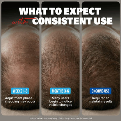 Minoxidil 5% Extra Strength Topical Solution for Men Hair Regrowth - Kirkland Signature 6-Month Supply, 6 x 60ml Bottles with Precision Dropper Applicator, Clinically Proven