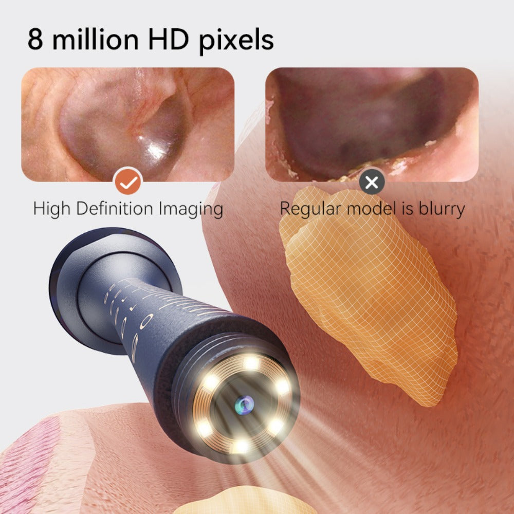 Rechargeable Camera Ear Cleaning Set with LED Light, Silicone Tips, Storage Case and Creamy White or Blue Finish