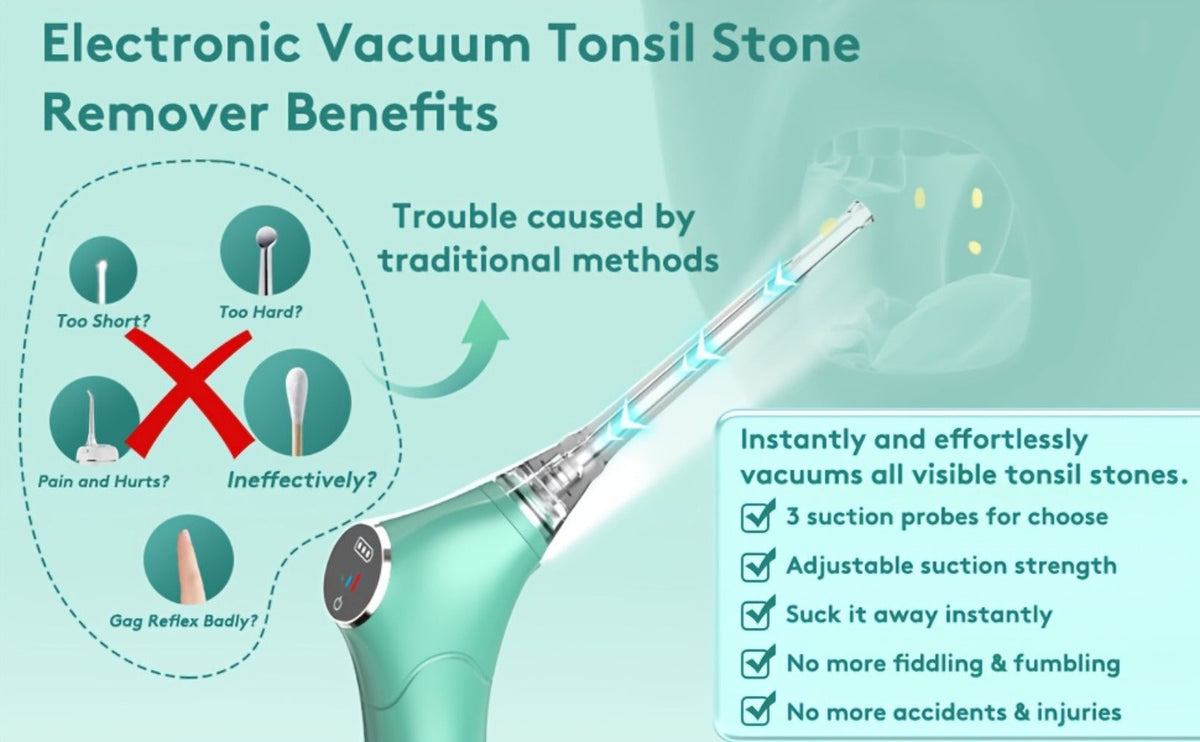 Tonsil Stone Remover Electric Vacuum Kit, Built-In LED Light, 3 Suction Modes & 5X Magnifying Mirror, Oral