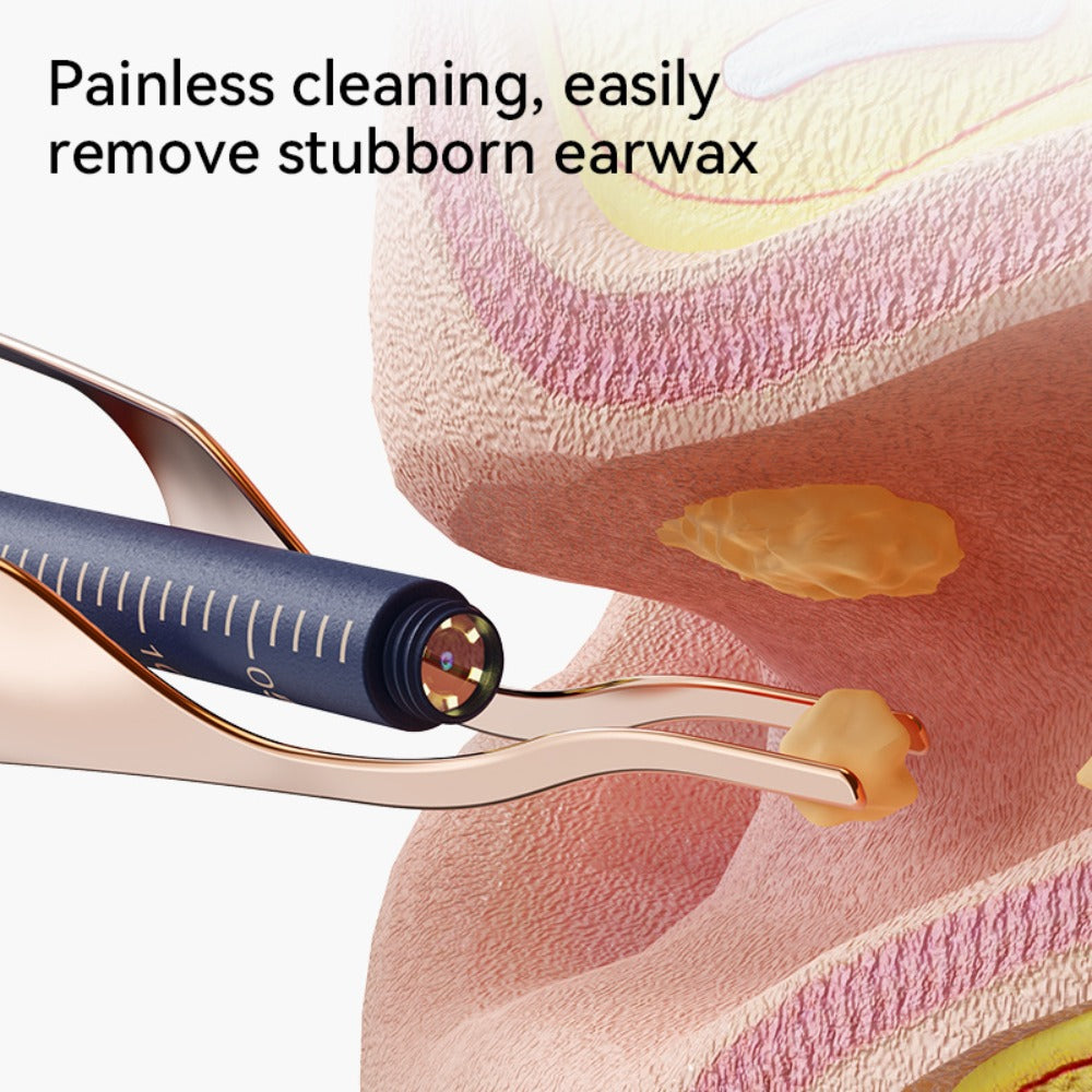 Rechargeable Camera Ear Cleaning Set with LED Light, Silicone Tips, Storage Case and Creamy White or Blue Finish