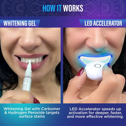 Wireless 16-LED Teeth Whitening Mouthpiece Kit with Two Gel Pens, Cleaning Case and Accessory Packs