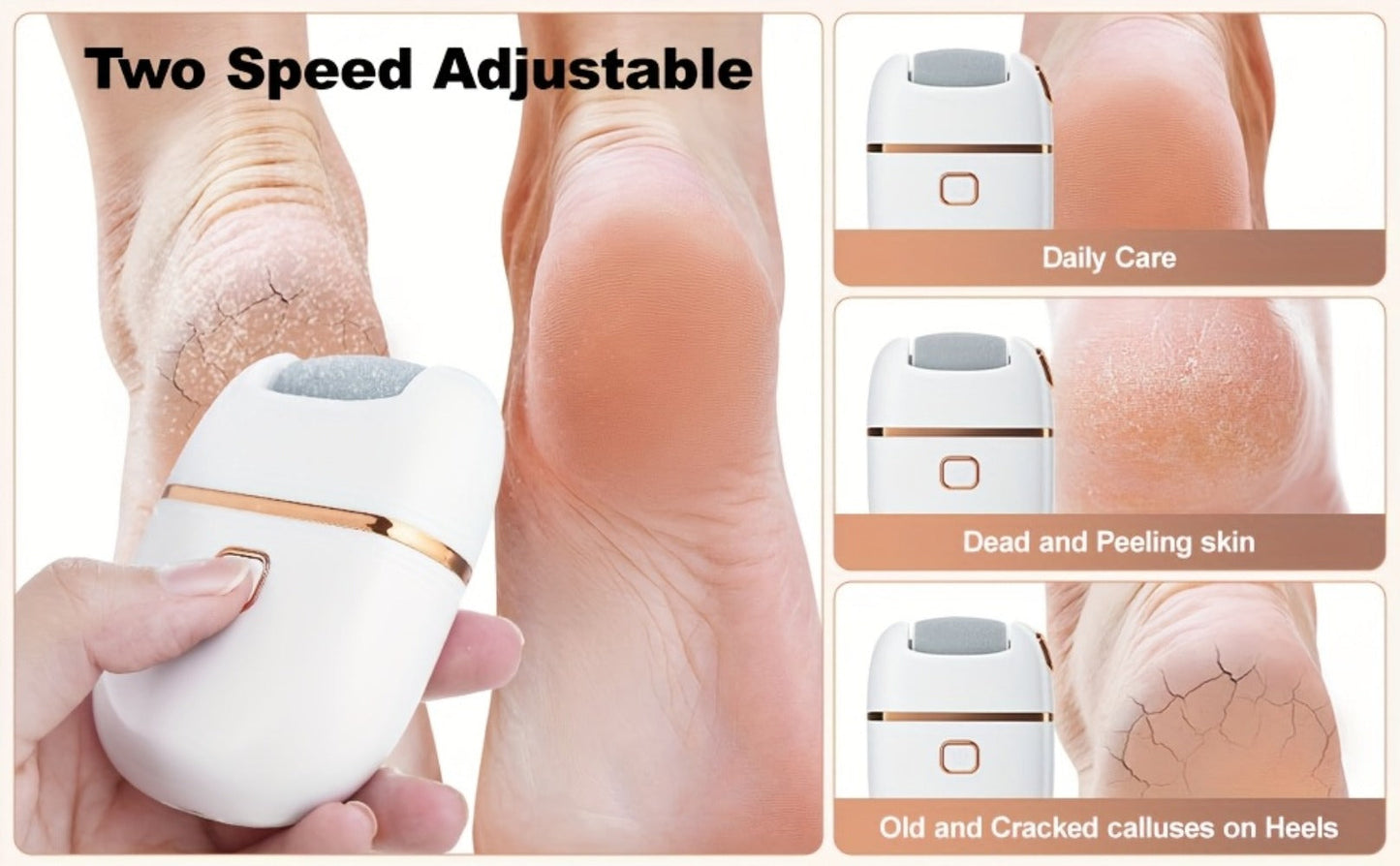 Rechargeable Electric Callus Remover with Three Replacement Heads, Two Speeds and USB Charging