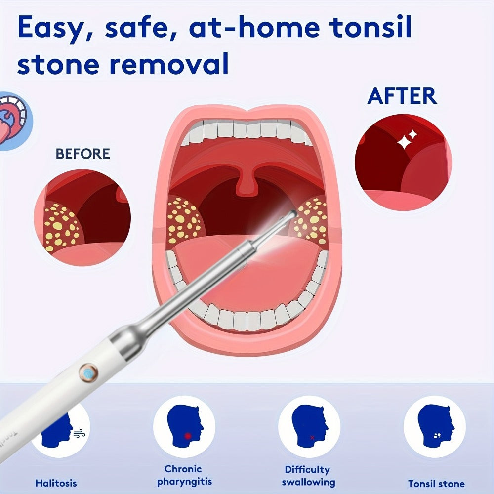 Visual Tonsil Stone Remover with 1080P HD Camera – 6 LED Lights, 5 Stainless Steel Heads, Bad Breath Prevention, iOS & Android Compatible, At-Home Tonsil Care Kit