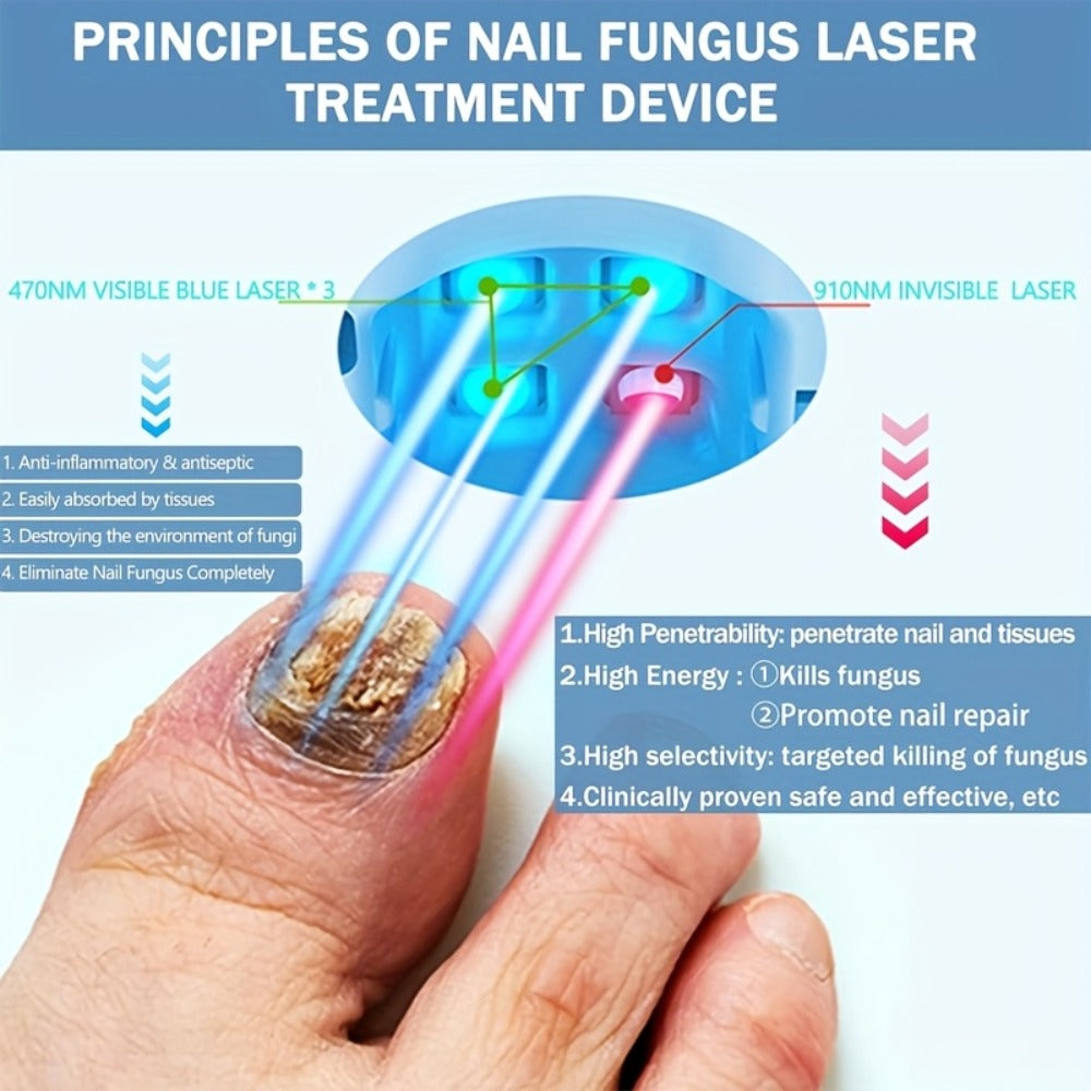 KTS Nail Fungus Laser Device FDA Cleared – Extra Strength 407nm Blue Light & 905nm Dual-Light Treatment for Toenail & Fingernail Fungus, Onychomycosis Home Removal Device