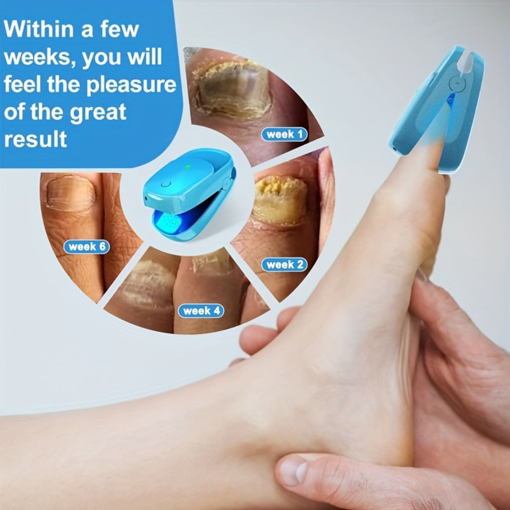 KTS Nail Fungus Laser Device FDA Cleared – Extra Strength 407nm Blue Light & 905nm Dual-Light Treatment for Toenail & Fingernail Fungus, Onychomycosis Home Removal Device