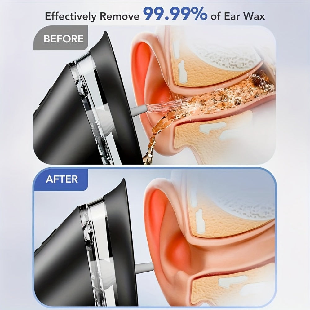 E80 Electric Ear Irrigation Kit with Three Modes, Dual Tank Sections, Temperature Display and USB Charging
