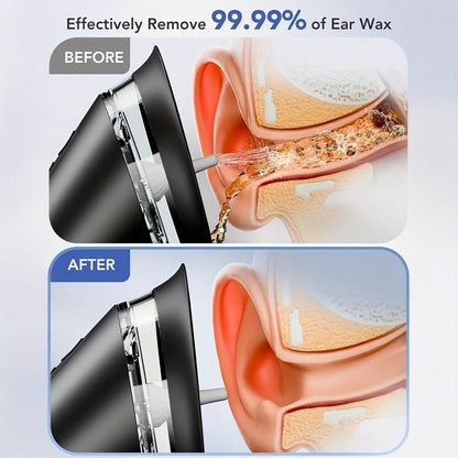 E80 Electric Ear Irrigation Kit with Three Modes, Dual Tank Sections, Temperature Display and USB Charging