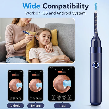Rechargeable Camera Ear Cleaning Set with LED Light, Silicone Tips, Storage Case and Creamy White or Blue Finish