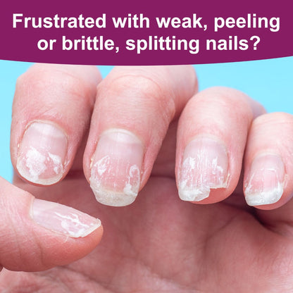 Nail Fortifier & Hardener 10ml Protective Strengthening Agent for Weak Damaged Brittle Nails – Makes Nails Stronger Tougher & Resilient, Clear Nail Repair Treatment Base Coat for Women