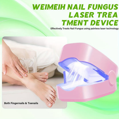 Nail Fungus Laser Treatment Device – FDA Cleared Anti-Fungal Laser for Toenail & Fingernail Fungal Infections, 7-Minute Home Treatment