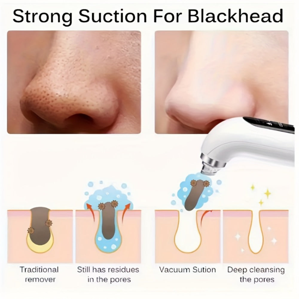 White Water-Tank Pore Vacuum Blackhead Remover with 3 Suction Levels and 6 Interchangeable Heads