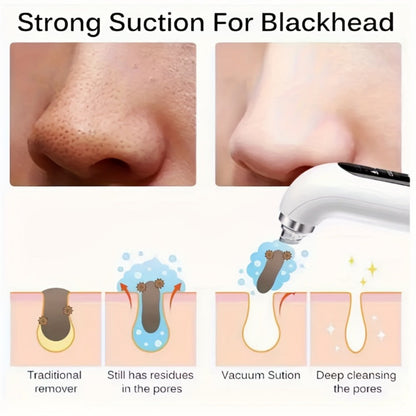 White Water-Tank Pore Vacuum Blackhead Remover with 3 Suction Levels and 6 Interchangeable Heads