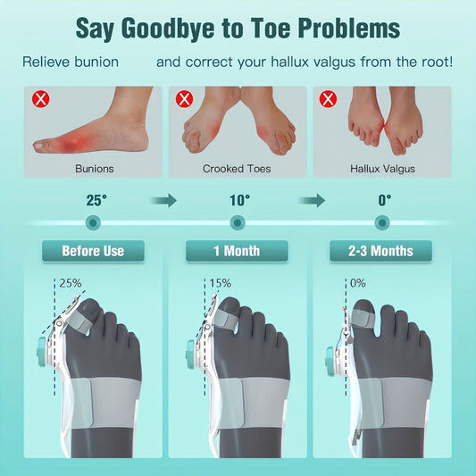 Bunion Corrector Big Toe Night Splint, Adjustable Hallux Valgus Brace with Knob & Heel Strap for Left & Right Foot, Toe Straightener for Men & Women – Relieves Bunion Pain & Corrects Toe Alignment (1pc)