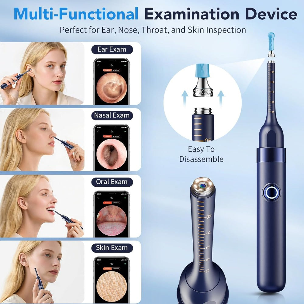 Rechargeable Camera Ear Cleaning Set with LED Light, Silicone Tips, Storage Case and Creamy White or Blue Finish