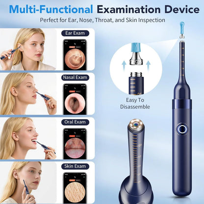 Rechargeable Camera Ear Cleaning Set with LED Light, Silicone Tips, Storage Case and Creamy White or Blue Finish