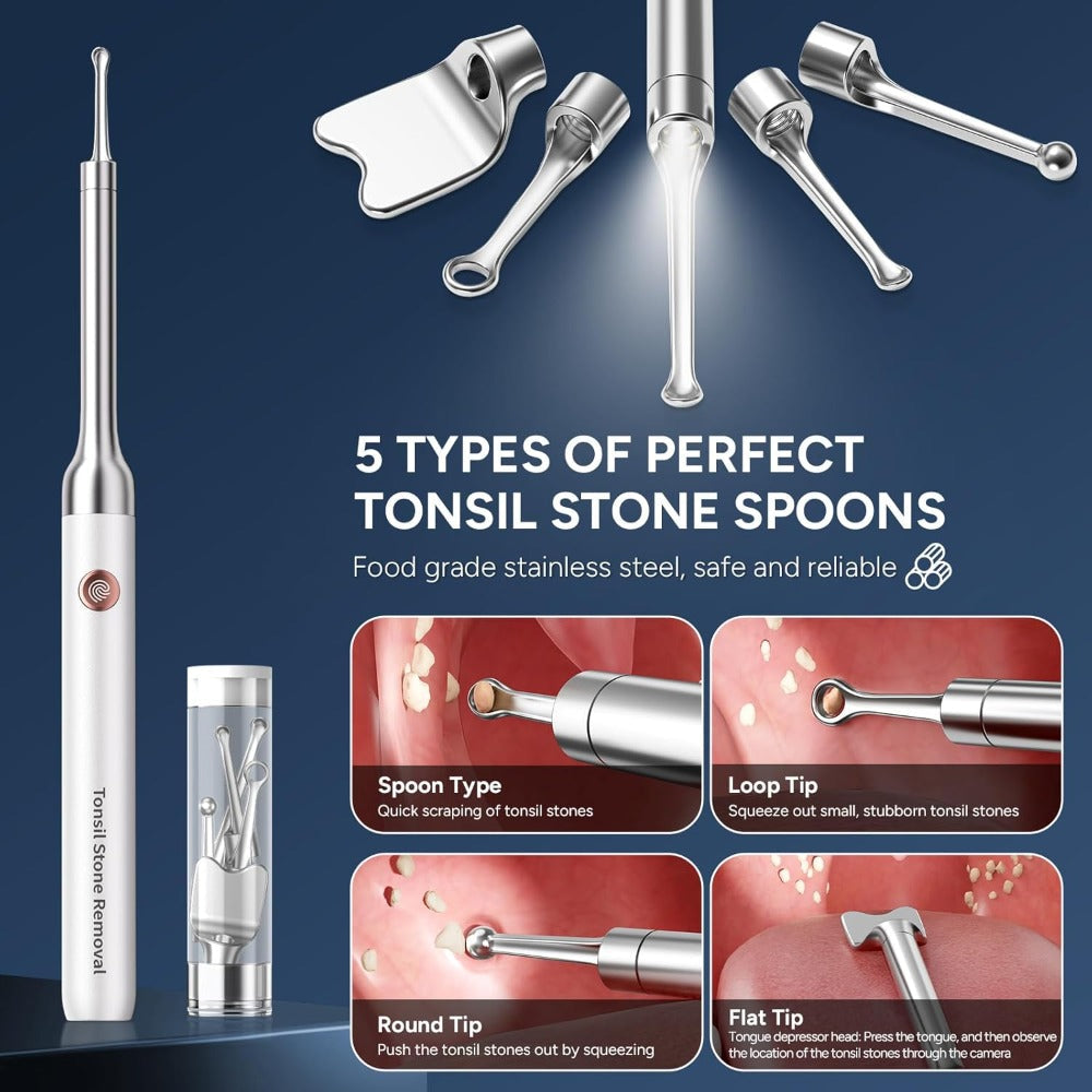 Visual Tonsil Stone Remover with 1080P HD Camera – 6 LED Lights, 5 Stainless Steel Heads, Bad Breath Prevention, iOS & Android Compatible, At-Home Tonsil Care Kit