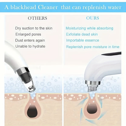 White Water-Tank Pore Vacuum Blackhead Remover with 3 Suction Levels and 6 Interchangeable Heads