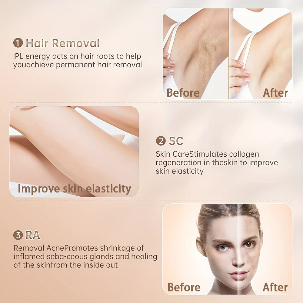 Sarisili AI01-12 IPL Hair Removal Device with Cooling Contact Area, Nine Levels and Manual or Auto Modes