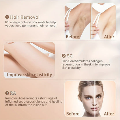 Sarisili AI01-12 IPL Hair Removal Device with Cooling Contact Area, Nine Levels and Manual or Auto Modes