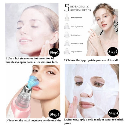 Pink Pore Vacuum Blackhead Remover with 3 Suction Levels, 5 Heads and 4 Manual Extractor Tools