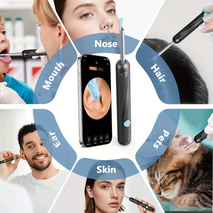 1080P-Marked Visual Ear Camera Kit with Six LED Lights, USB Charging and Black or White Accessory Sets