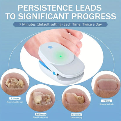 KTS Nail Fungus Laser Device FDA Cleared – Extra Strength 407nm Blue Light & 905nm Dual-Light Treatment for Toenail & Fingernail Fungus, Onychomycosis Home Removal Device